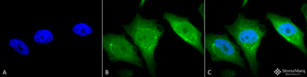 Immunocytochemistry/Immunofluorescence analysis using Rabbit Anti-Calnexin-CT Polyclonal Antibody (STPA00031). Tissue: Heat Shocked Cervical cancer cell line (HeLa). Species: Human. Fixation: 2% Formaldehyde for 20 min at RT. Primary Antibody: Rabbit Anti-Calnexin-CT Polyclonal Antibody (STPA00031) at 1:80 for 12 hours at 4°C. Secondary Antibody: FITC Goat Anti-Rabbit (green) at 1:200 for 2 hours at RT.