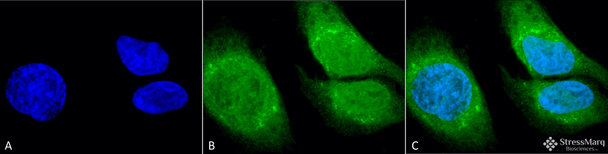 Immunocytochemistry/Immunofluorescence analysis using Rabbit Anti-GRP78 (Bip) Polyclonal Antibody (STPA00029). Tissue: Heat Shocked Cervical cancer cell line (HeLa). Species: Human. Fixation: 2% Formaldehyde for 20 min at RT. Primary Antibody: Rabbit Anti-GRP78 (Bip) Polyclonal Antibody (STPA00029) at 1:100 for 12 hours at 4°C. Secondary Antibody: FITC Goat Anti-Rabbit (green) at 1:200 for 2 hours at RT.