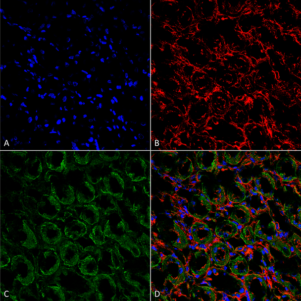Immunohistochemistry analysis using Rabbit Anti-ENaC Polyclonal Antibody (STPA00047). Tissue: kidney tissue. Species: Rat. Fixation: Formalin Fixed Paraffin-Embedded. Primary Antibody: Rabbit Anti-ENaC Polyclonal Antibody (STPA00047) at 1:25 for 1 hour at RT. Secondary Antibody: Goat Anti-Rabbit IgG: Alexa Fluor 488. Counterstain: Actin-binding Phalloidin-Alexa Fluor 633; DAPI (blue) nuclear stain. Magnification: 63X.