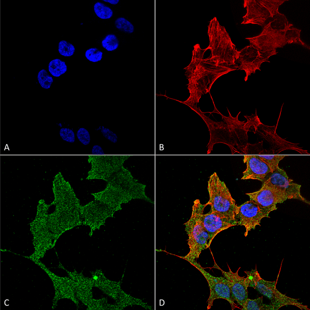Immunocytochemistry/Immunofluorescence analysis using Rabbit Anti-ULK1 Polyclonal Antibody (STPA00063). Tissue: Neuroblastoma cell line (SK-N-BE). Species: Human. Fixation: 4% Formaldehyde for 15 min at RT. Primary Antibody: Rabbit Anti-ULK1 Polyclonal Antibody (STPA00063) at 1:100 for 60 min at RT. Secondary Antibody: Goat Anti-Rabbit ATTO 488 at 1:200 for 60 min at RT.
