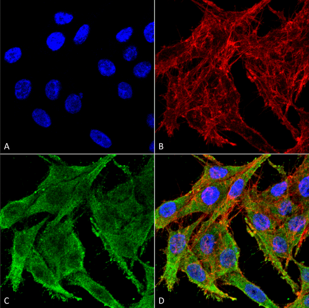 Immunocytochemistry/Immunofluorescence analysis using Rabbit Anti-Kir4.1 Polyclonal Antibody (STPA00071). Tissue: Colon carcinoma cell line (RKO). Species: Human. Fixation: 4% Formaldehyde for 15 min at RT. Primary Antibody: Rabbit Anti-Kir4.1 Polyclonal Antibody (STPA00071) at 1:100 for 60 min at RT. Secondary Antibody: Goat Anti-Rabbit ATTO 488 at 1:100 for 60 min at RT.