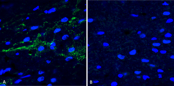 Immunohistochemistry analysis using Rabbit Anti-Alpha Synuclein (pSer129) Polyclonal Antibody (STPA00078). Tissue: Free floating brain sections. Species: Mouse. Fixation: PFA. Primary Antibody: Rabbit Anti-Alpha Synuclein (pSer129) Polyclonal Antibody (STPA00078) at 1:500 for overnight at 4C with gentle agitation. Counterstain: Hoechst. Magnification: 63X. A) Right hemisphere (striatum) injected with alpha synuclein AAV vector. B) Control.