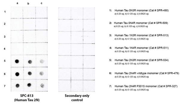 Dot blot analysis comparing detection of Tau isoforms. Of note is that STPA00091 does not bind to 0N or 1N isoforms. Block: 5% skim milk. Primary Antibody: Anti-human Tau 2N3R/4R polyclonal antibody (STPA00091) incubated for 1/2 hour at RT. Secondary Antibody: Goat anti-rabbit IgG:HRP at 1:4000 for 1/2 hour at RT. Color Development: Chemiluminescent for HRP (Moss) for 1 min in RT. Exposed 1 second.