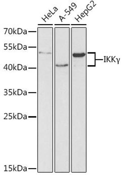 Anti-IKKGamma Antibody (CAB0917)