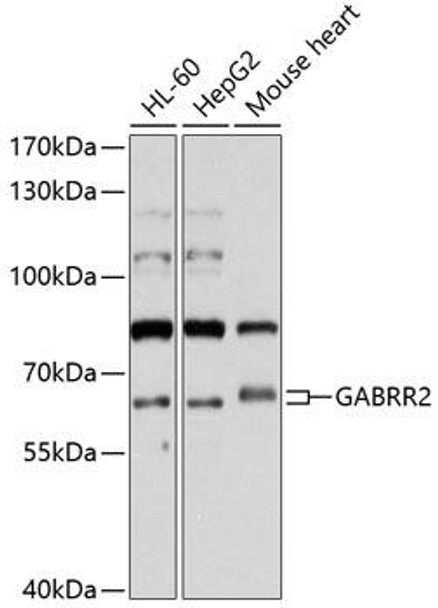 Anti-GABRR2 Antibody (CAB10111)