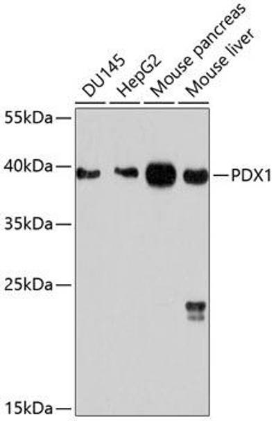 Anti-PDX1 Antibody (CAB10173)