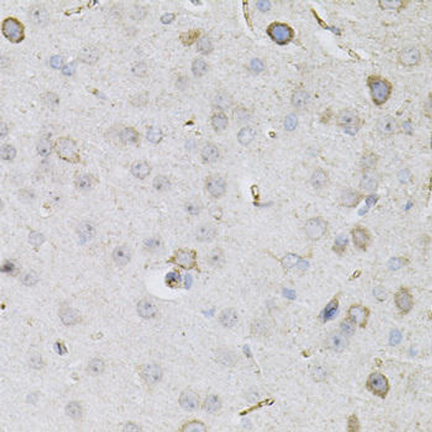 Anti-CEACAM5 Antibody (CAB12421)
