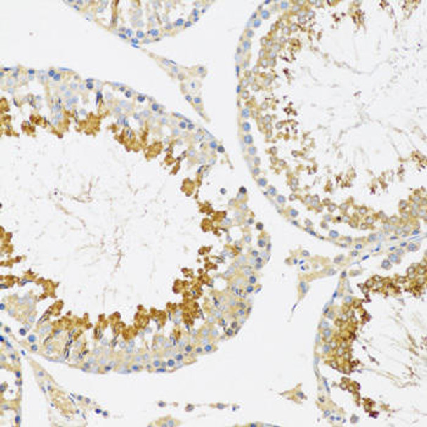 Anti-SRPK1 Antibody (CAB12510)