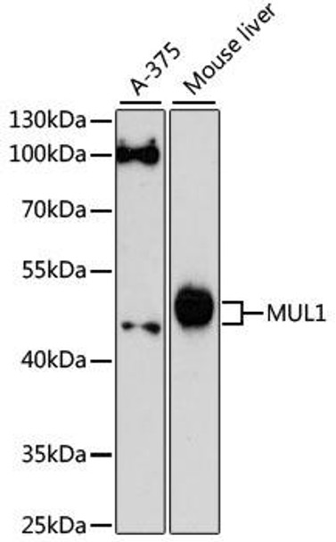 Anti-MUL1 Antibody (CAB13125)