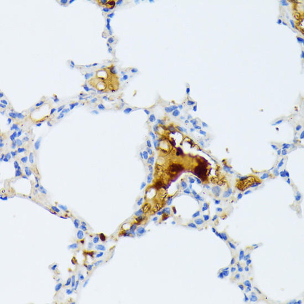 Anti-CTRB1 Antibody (CAB15043)