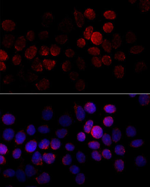 Anti-CYP2J2 Antibody (CAB15045)