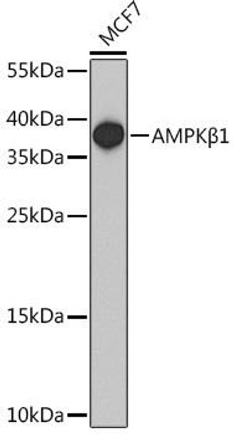 Anti-AMPKBeta1 Antibody (CAB15708)