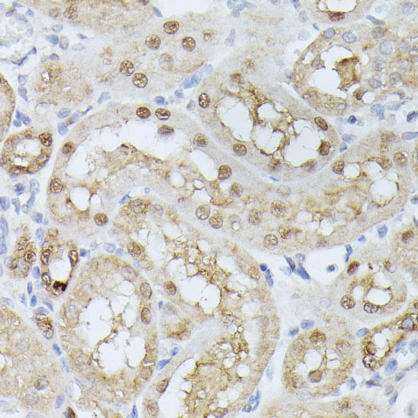 Anti-TPI1 Antibody (CAB15733)