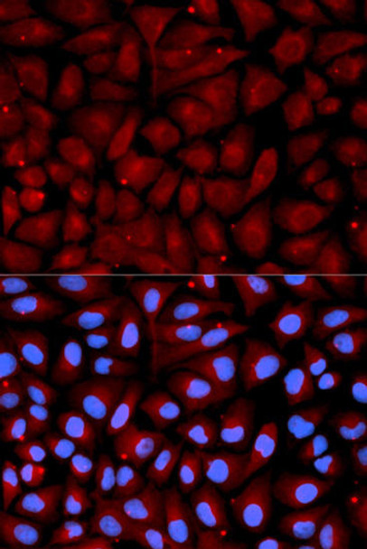 Anti-SERPINC1 Antibody (CAB1574)