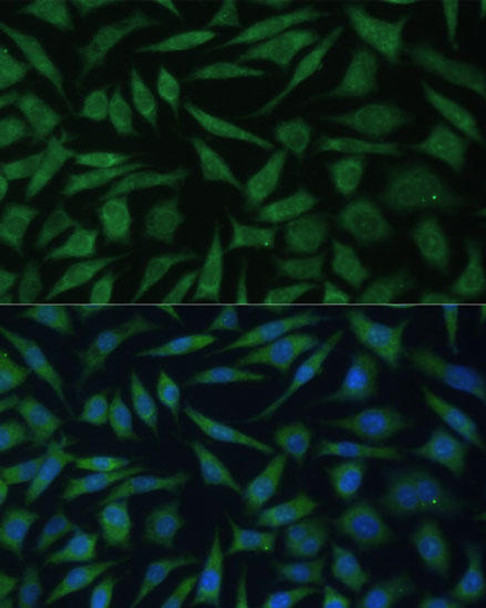 Anti-REXO2 Antibody (CAB15808)