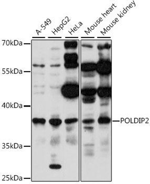 Anti-POLDIP2 Antibody (CAB15812)