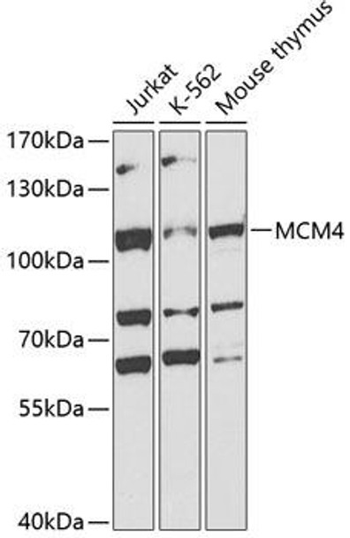 Anti-MCM4 Antibody (CAB3018)