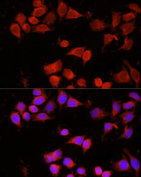 Anti-AAMP Antibody (CAB3283)