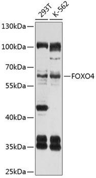 Anti-FOXO4 Antibody (CAB3307)