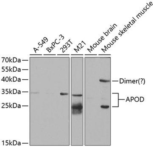 Anti-APOD Antibody (CAB5297)