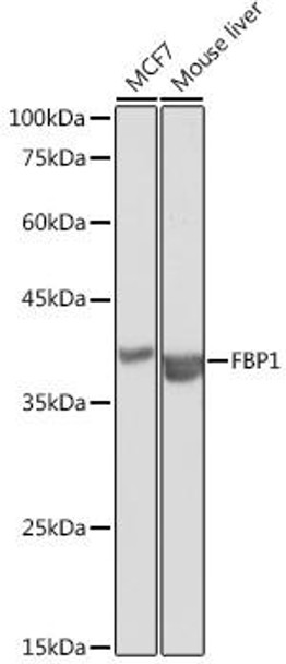 Anti-FBP1 Antibody (CAB5406)