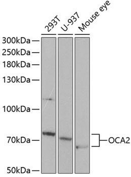 Anti-OCA2 Antibody (CAB5653)