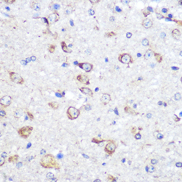 Anti-DICER1 Antibody (CAB6021)