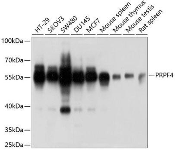 Anti-PRPF4 Antibody (CAB6052)