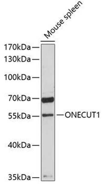 Anti-ONECUT1 Antibody (CAB9668)