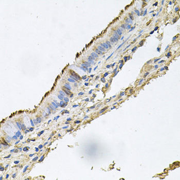 Anti-Desmoglein-1 Antibody (CAB9812)