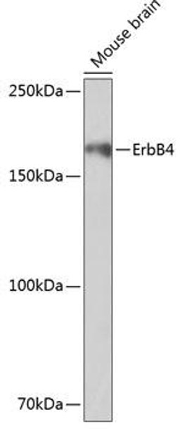 Anti-ErbB4 Antibody (CAB19047)