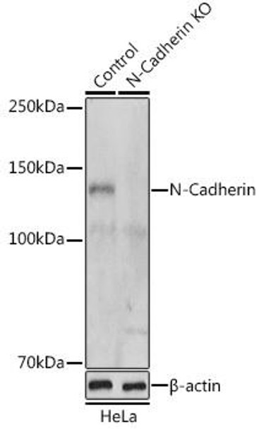 Anti-N-Cadherin Antibody (CAB0432)[KO Validated]