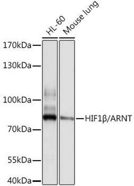 Anti-HIF1Beta/ARNT Antibody (CAB0972)