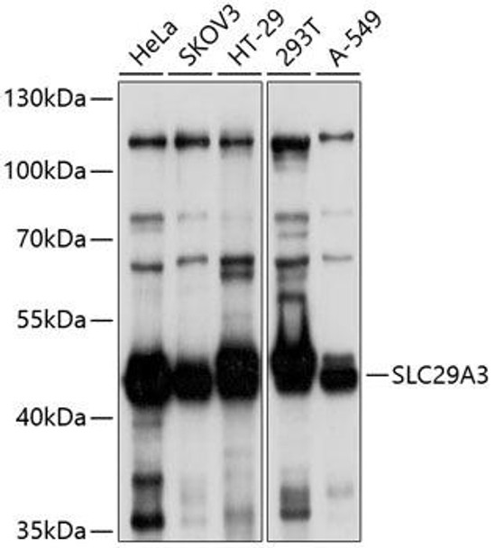 Anti-SLC29A3 Antibody (CAB10377)