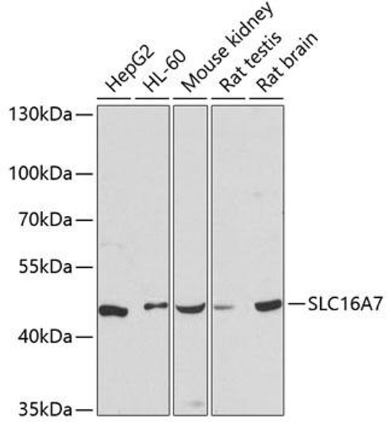 Anti-SLC16A7 Antibody (CAB12386)