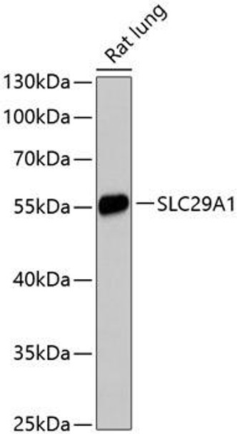 Anti-SLC29A1 Antibody (CAB13205)