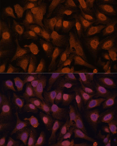 Anti-ZNF131 Antibody (CAB15331)