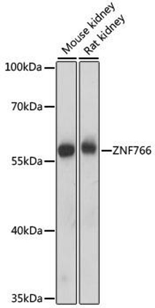 Anti-ZNF766 Antibody (CAB15925)