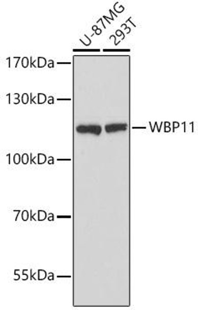 Anti-WBP11 Antibody (CAB16191)