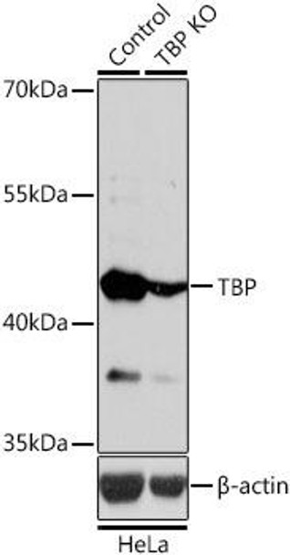 Anti-TBP Antibody (CAB2192)[KO Validated]