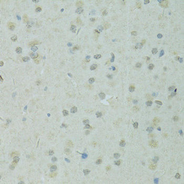 Anti-TRIM28 Antibody (CAB2245)