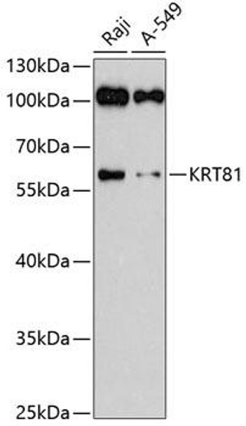 Anti-KRT81 Antibody (CAB3940)