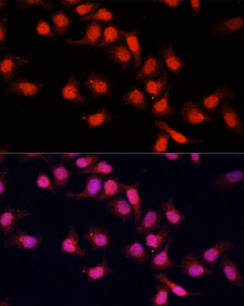 Anti-PRDM14 Antibody (CAB5543)