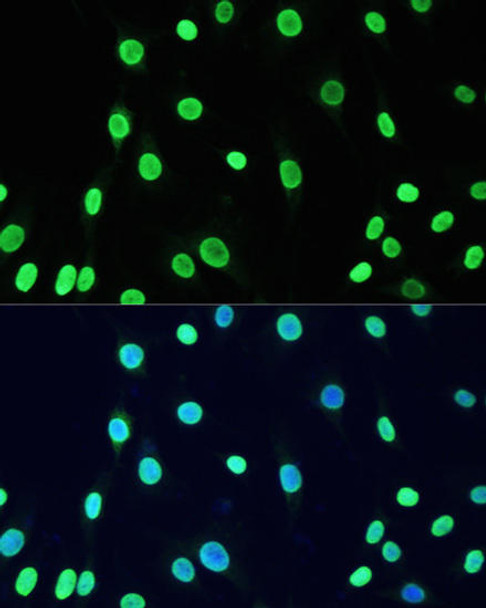 Anti-Acetyl-DNMT1-K1127/K1129/K1131/K1133 Antibody (CAB5595)