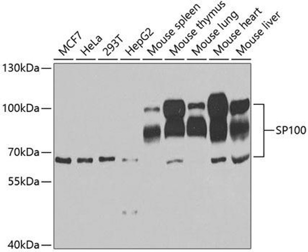 Anti-SP100 Antibody (CAB5851)