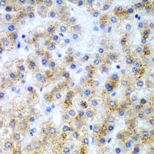 Anti-LY86 Antibody (CAB6185)