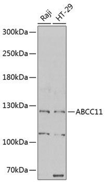 Anti-ABCC11 Antibody (CAB6514)