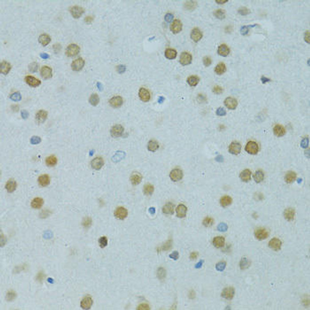 Anti-MUS81 Antibody (CAB6818)