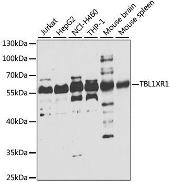 Anti-TBL1XR1 Antibody (CAB7834)