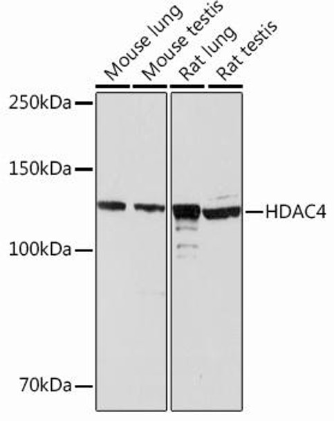 Anti-HDAC4 Antibody (CAB13510)